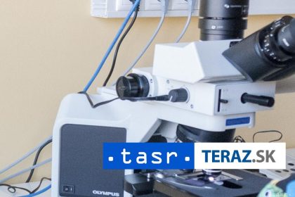 Vzacny nalez Tim vedcov objavil jednobunkovca