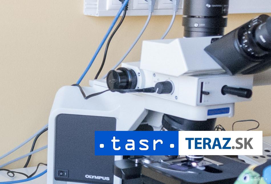 Vzacny nalez Tim vedcov objavil jednobunkovca