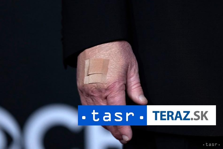 Biely dom spojil naplasti na Trumpovej ruke s podavanim ruk