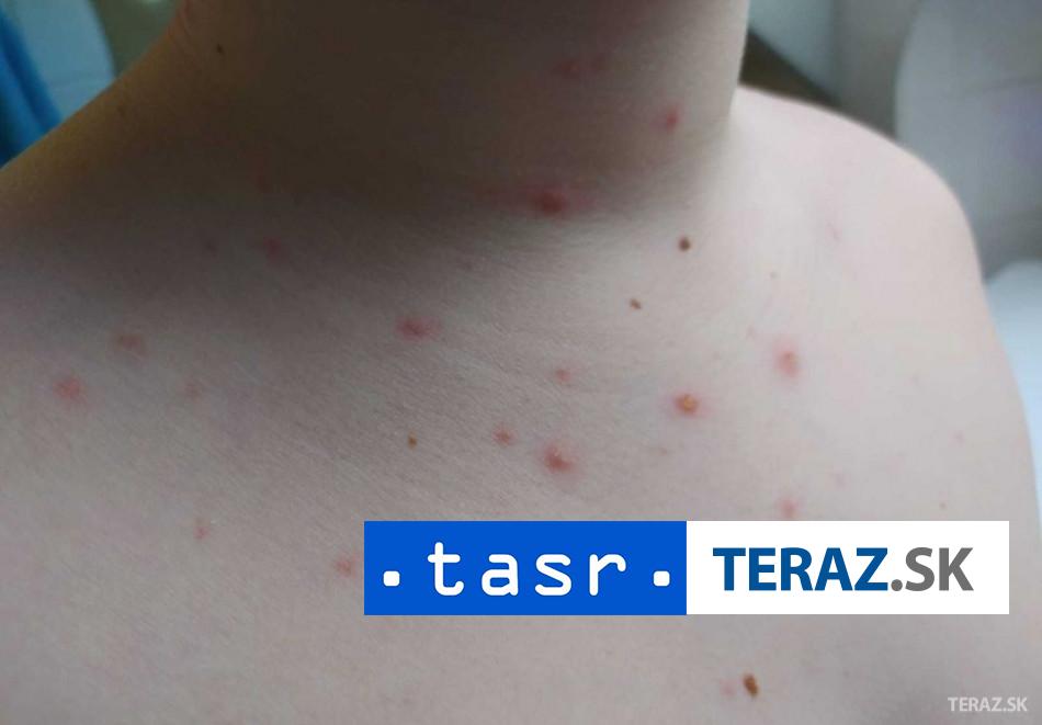 Na osypy v Bangladeshi zomrelo takmer 500 deti