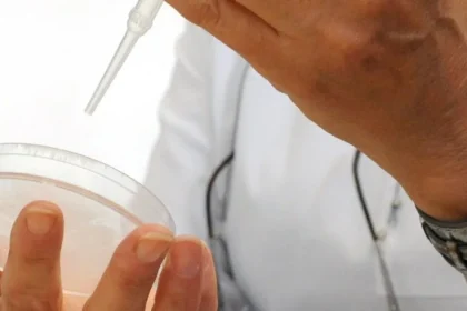 Od začiatku epidémie eboly zaznamenali v KDR už viac ako 7000 prípadov